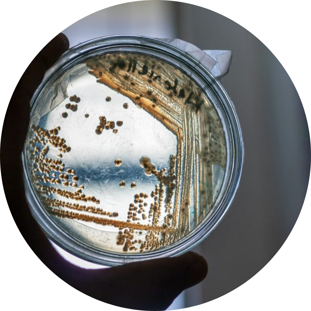 Mikrobielle Sanierung